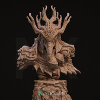 Nrk-250501 Famine Bust