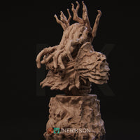 Nrk-250501 Famine Bust